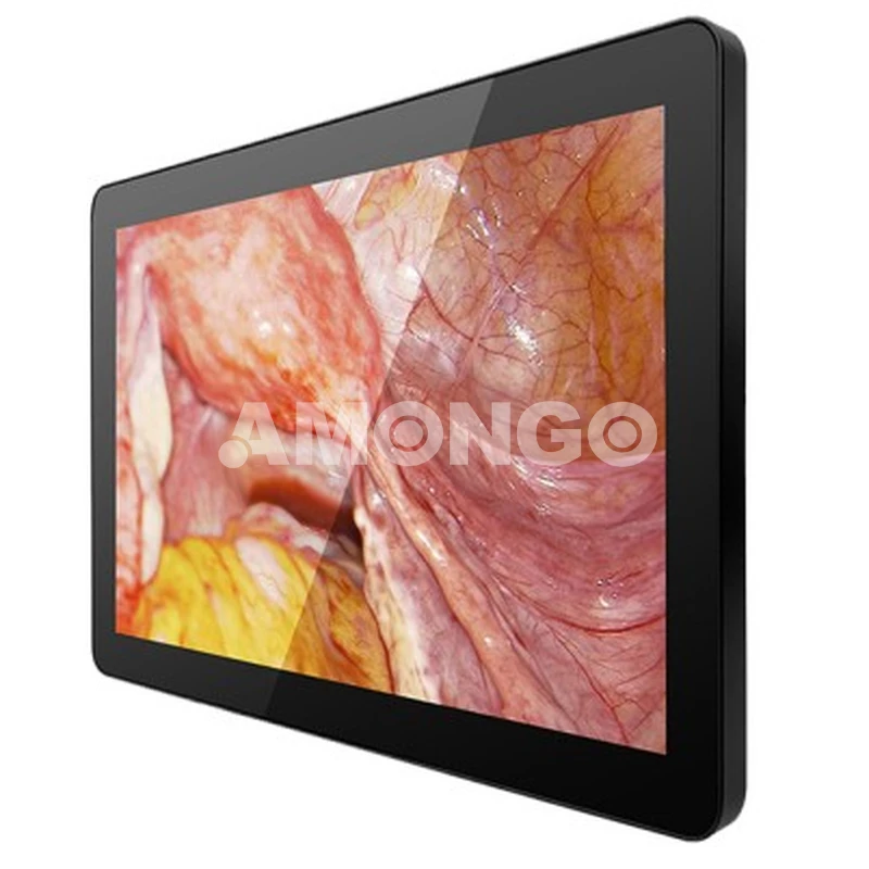 AMG 15OPTD01G1 Medical Display producenter